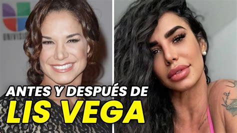 lis vega antes y después|¡Cómo ha cambiado! Lis Vega cumplió 42 años, mira su increíble antes y ...